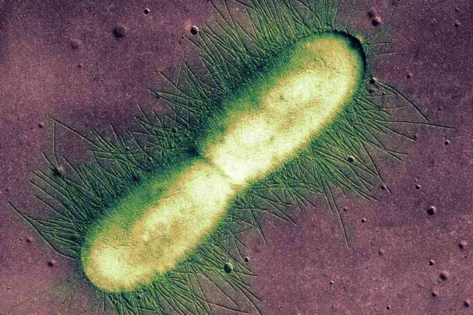 E. coli-bakteeri