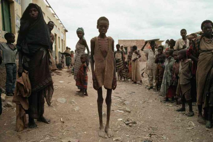 Somalian sisällissodan seurauksena nälänhätä uhrit.